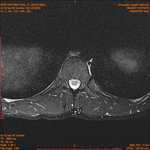 2026-04-15/Entire Spine/Ax t2 tse DR lumbar/0002-IM112.png