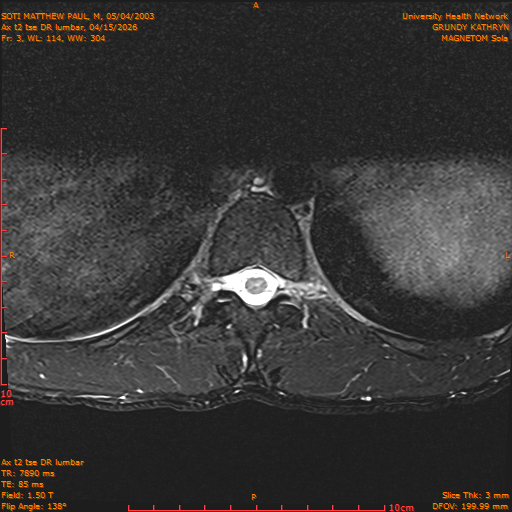 2026-04-15/Entire Spine/Ax t2 tse DR lumbar/0004-IM114.png
