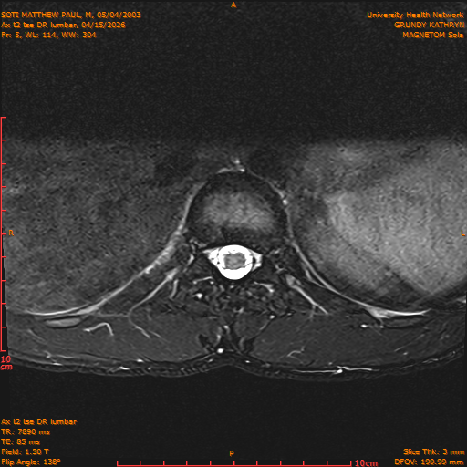 2026-04-15/Entire Spine/Ax t2 tse DR lumbar/0006-IM116.png