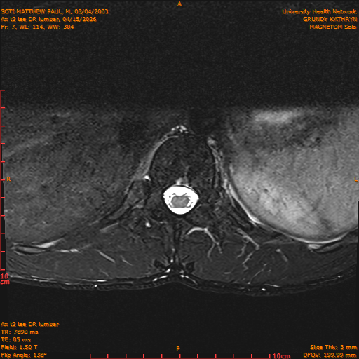 2026-04-15/Entire Spine/Ax t2 tse DR lumbar/0008-IM118.png