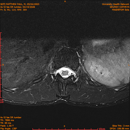 2026-04-15/Entire Spine/Ax t2 tse DR lumbar/0009-IM119.png