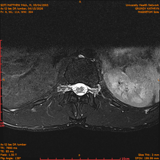 2026-04-15/Entire Spine/Ax t2 tse DR lumbar/0010-IM120.png