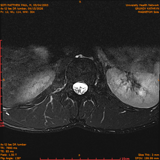 2026-04-15/Entire Spine/Ax t2 tse DR lumbar/0013-IM123.png