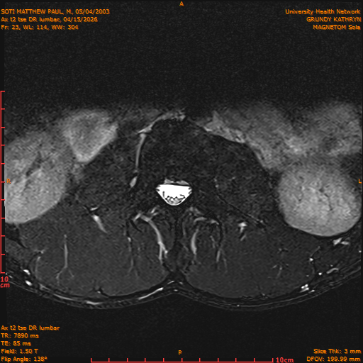 2026-04-15/Entire Spine/Ax t2 tse DR lumbar/0024-IM134.png