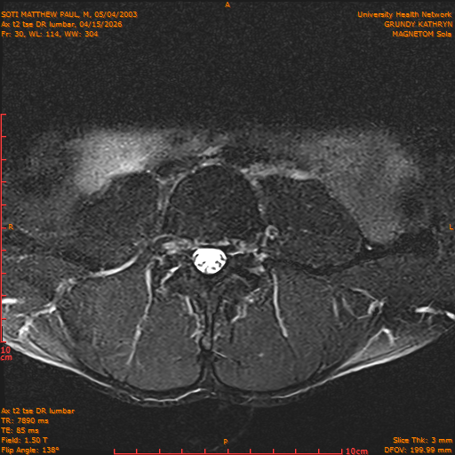 2026-04-15/Entire Spine/Ax t2 tse DR lumbar/0031-IM141.png
