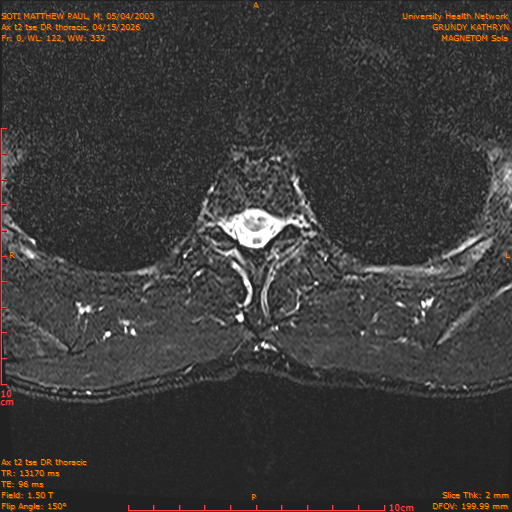 2026-04-15/Entire Spine/Ax t2 tse DR thoracic/0001-.png