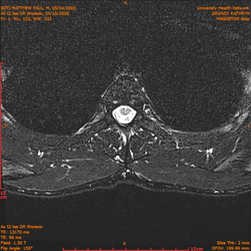 2026-04-15/Entire Spine/Ax t2 tse DR thoracic/0002-.png