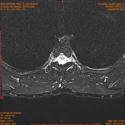 2026-04-15/Entire Spine/Ax t2 tse DR thoracic/0005-.png