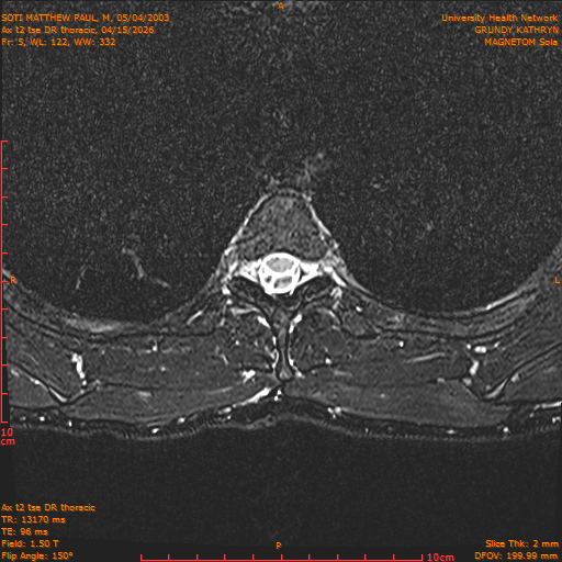 2026-04-15/Entire Spine/Ax t2 tse DR thoracic/0006-.png