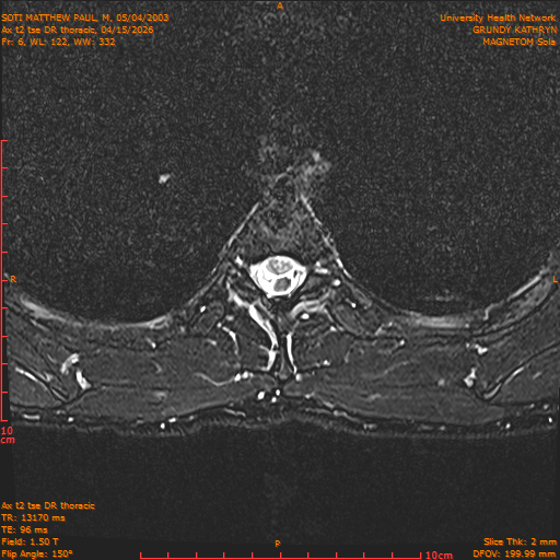 2026-04-15/Entire Spine/Ax t2 tse DR thoracic/0007-.png