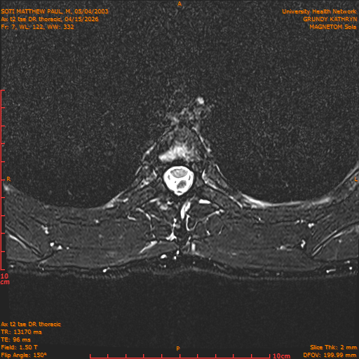 2026-04-15/Entire Spine/Ax t2 tse DR thoracic/0008-.png