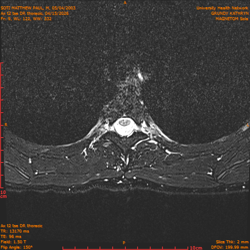 2026-04-15/Entire Spine/Ax t2 tse DR thoracic/0010-.png