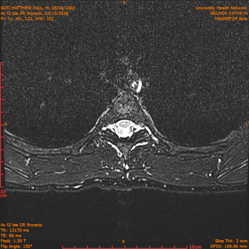 2026-04-15/Entire Spine/Ax t2 tse DR thoracic/0012-.png