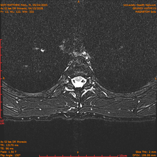 2026-04-15/Entire Spine/Ax t2 tse DR thoracic/0013-.png