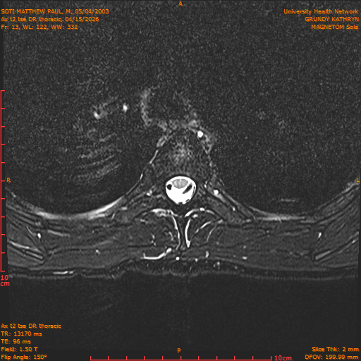 2026-04-15/Entire Spine/Ax t2 tse DR thoracic/0014-.png