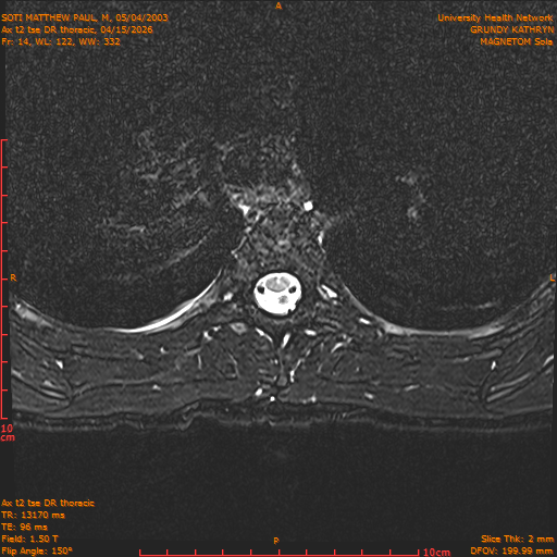 2026-04-15/Entire Spine/Ax t2 tse DR thoracic/0015-.png