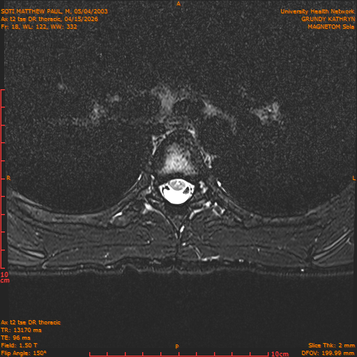 2026-04-15/Entire Spine/Ax t2 tse DR thoracic/0019-.png