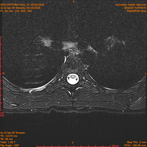 2026-04-15/Entire Spine/Ax t2 tse DR thoracic/0021-.png