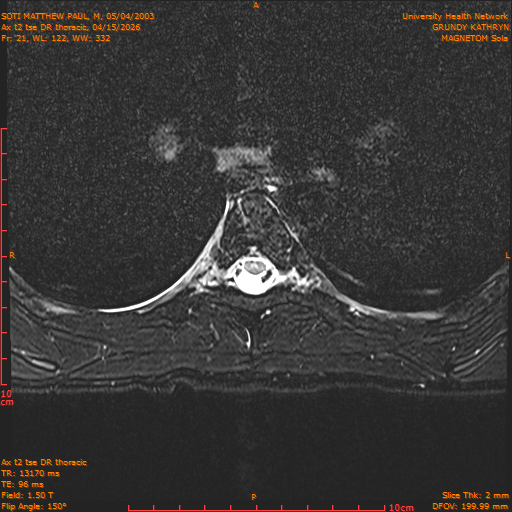 2026-04-15/Entire Spine/Ax t2 tse DR thoracic/0022-.png