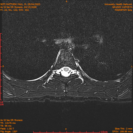 2026-04-15/Entire Spine/Ax t2 tse DR thoracic/0023-.png