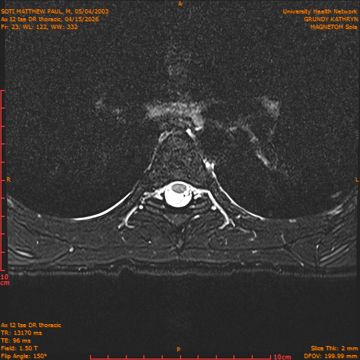 2026-04-15/Entire Spine/Ax t2 tse DR thoracic/0024-.png
