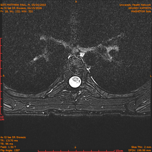 2026-04-15/Entire Spine/Ax t2 tse DR thoracic/0027-.png