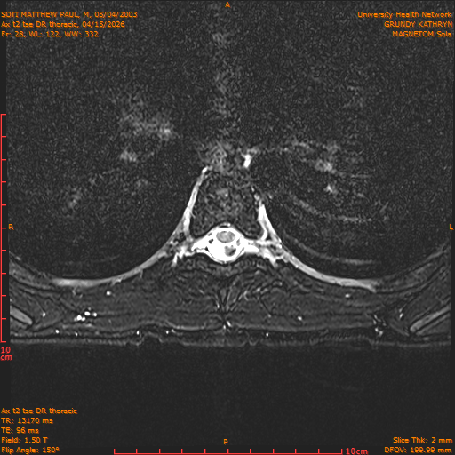 2026-04-15/Entire Spine/Ax t2 tse DR thoracic/0029-.png
