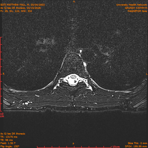 2026-04-15/Entire Spine/Ax t2 tse DR thoracic/0030-.png