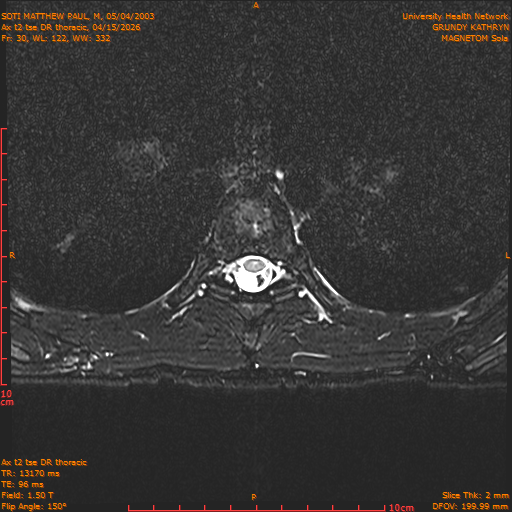 2026-04-15/Entire Spine/Ax t2 tse DR thoracic/0031-.png
