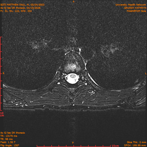 2026-04-15/Entire Spine/Ax t2 tse DR thoracic/0032-.png