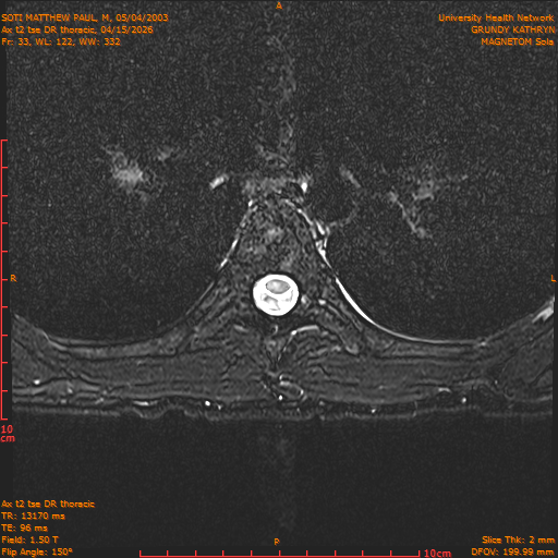 2026-04-15/Entire Spine/Ax t2 tse DR thoracic/0034-.png