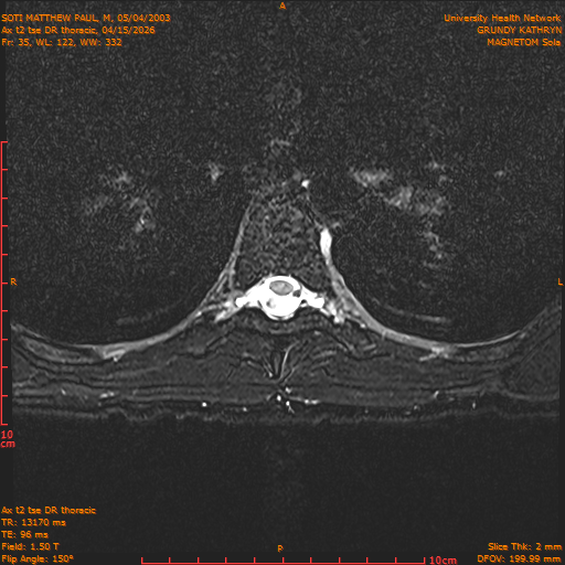 2026-04-15/Entire Spine/Ax t2 tse DR thoracic/0036-.png