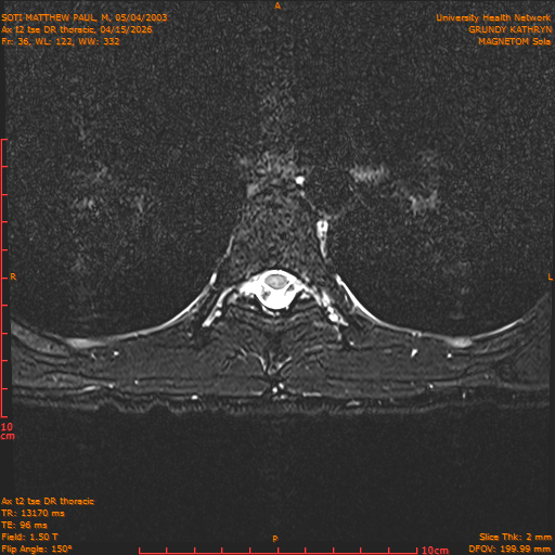 2026-04-15/Entire Spine/Ax t2 tse DR thoracic/0037-.png