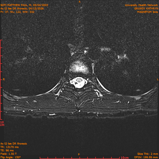 2026-04-15/Entire Spine/Ax t2 tse DR thoracic/0038-.png