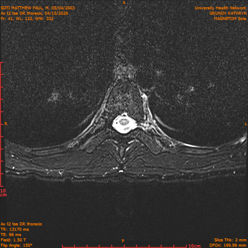 2026-04-15/Entire Spine/Ax t2 tse DR thoracic/0042-.png