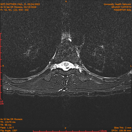 2026-04-15/Entire Spine/Ax t2 tse DR thoracic/0043-.png