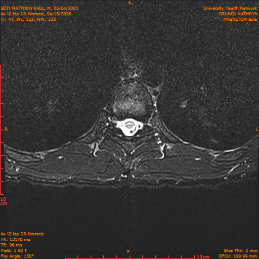 2026-04-15/Entire Spine/Ax t2 tse DR thoracic/0045-IM101.png