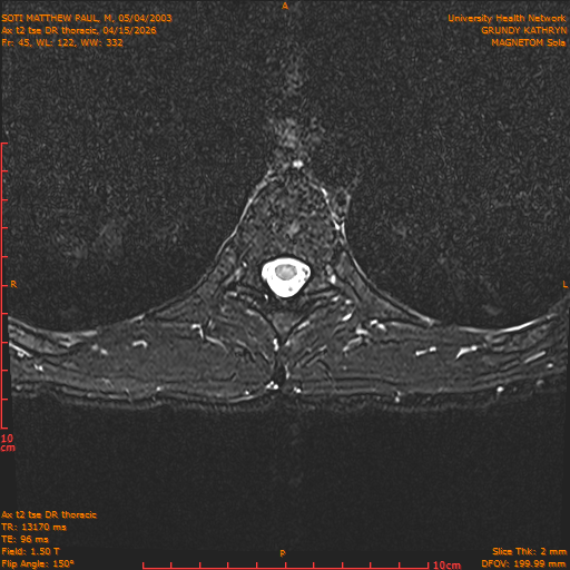 2026-04-15/Entire Spine/Ax t2 tse DR thoracic/0046-IM102.png