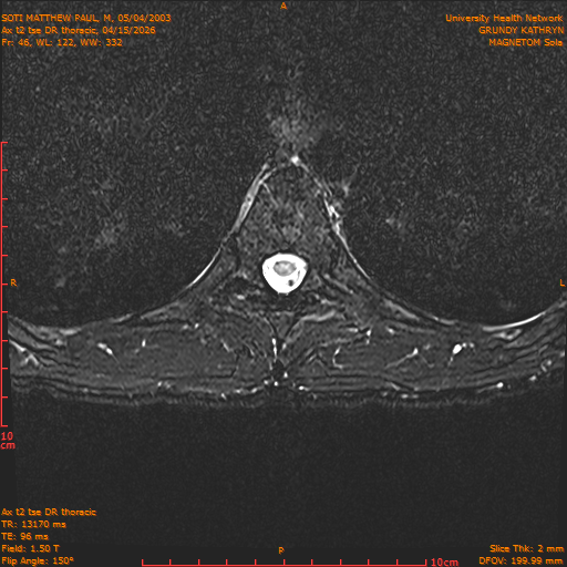 2026-04-15/Entire Spine/Ax t2 tse DR thoracic/0047-IM103.png