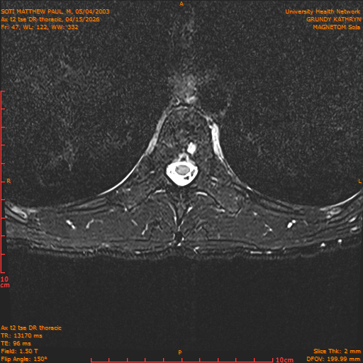 2026-04-15/Entire Spine/Ax t2 tse DR thoracic/0048-IM104.png