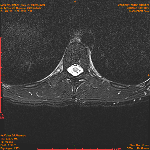2026-04-15/Entire Spine/Ax t2 tse DR thoracic/0049-IM105.png