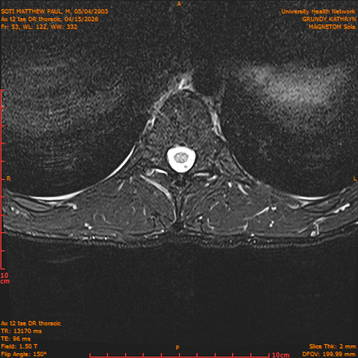 2026-04-15/Entire Spine/Ax t2 tse DR thoracic/0054-IM110.png