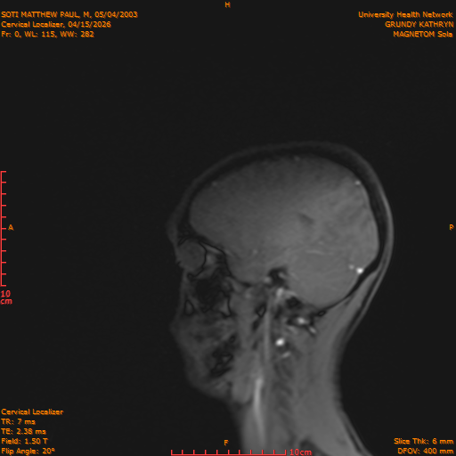2026-04-15/Entire Spine/Cervical Localizer/0001-.png