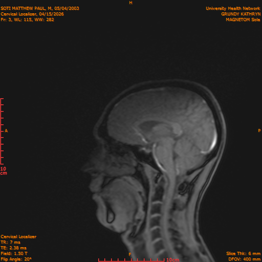 2026-04-15/Entire Spine/Cervical Localizer/0004-.png
