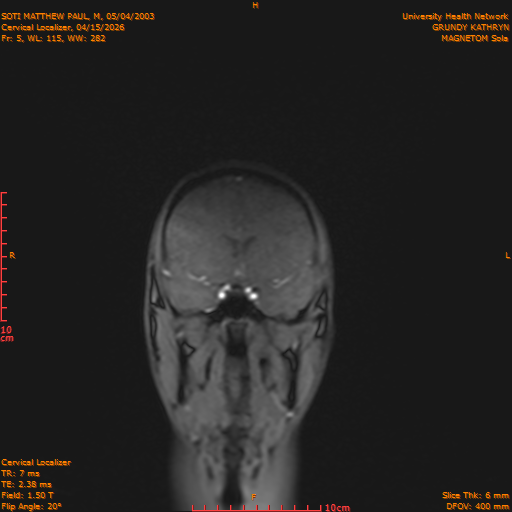 2026-04-15/Entire Spine/Cervical Localizer/0006-.png