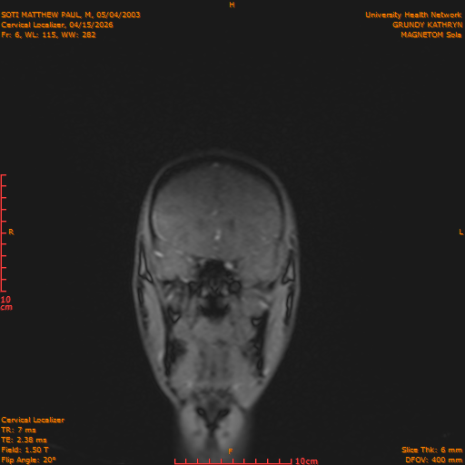 2026-04-15/Entire Spine/Cervical Localizer/0007-.png