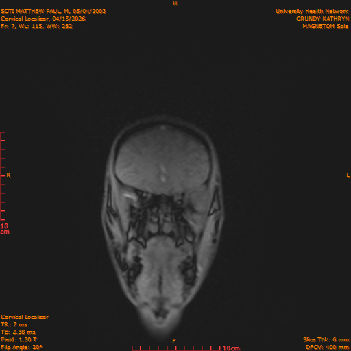 2026-04-15/Entire Spine/Cervical Localizer/0008-.png