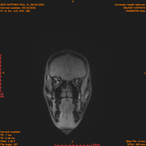 2026-04-15/Entire Spine/Cervical Localizer/0009-.png
