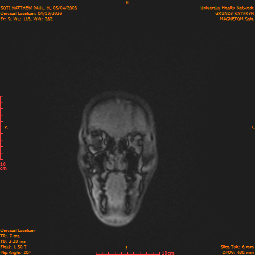 2026-04-15/Entire Spine/Cervical Localizer/0010-.png