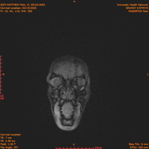 2026-04-15/Entire Spine/Cervical Localizer/0011-.png